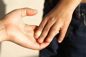 リンガルブラケット矯正法のメリットは
