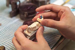 三宮で見つかる信頼の矯正歯科：口コミと実績で選ぶ最適な治療プラン